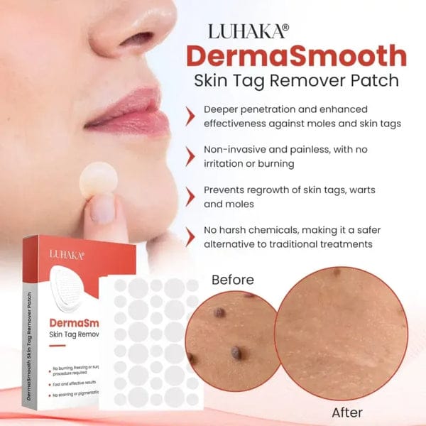 Derma Smooth Skin Tag Removal Patch _ 72 Patches